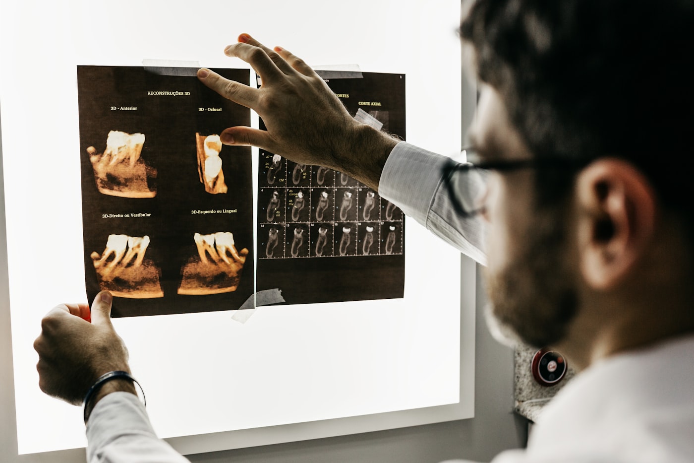 Dentist reading dental x-rays on a lightboard